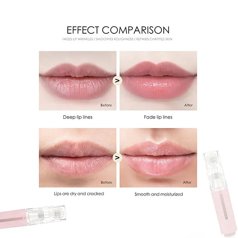 Lip Derma Stamp 0.25 mm (Stimulate)