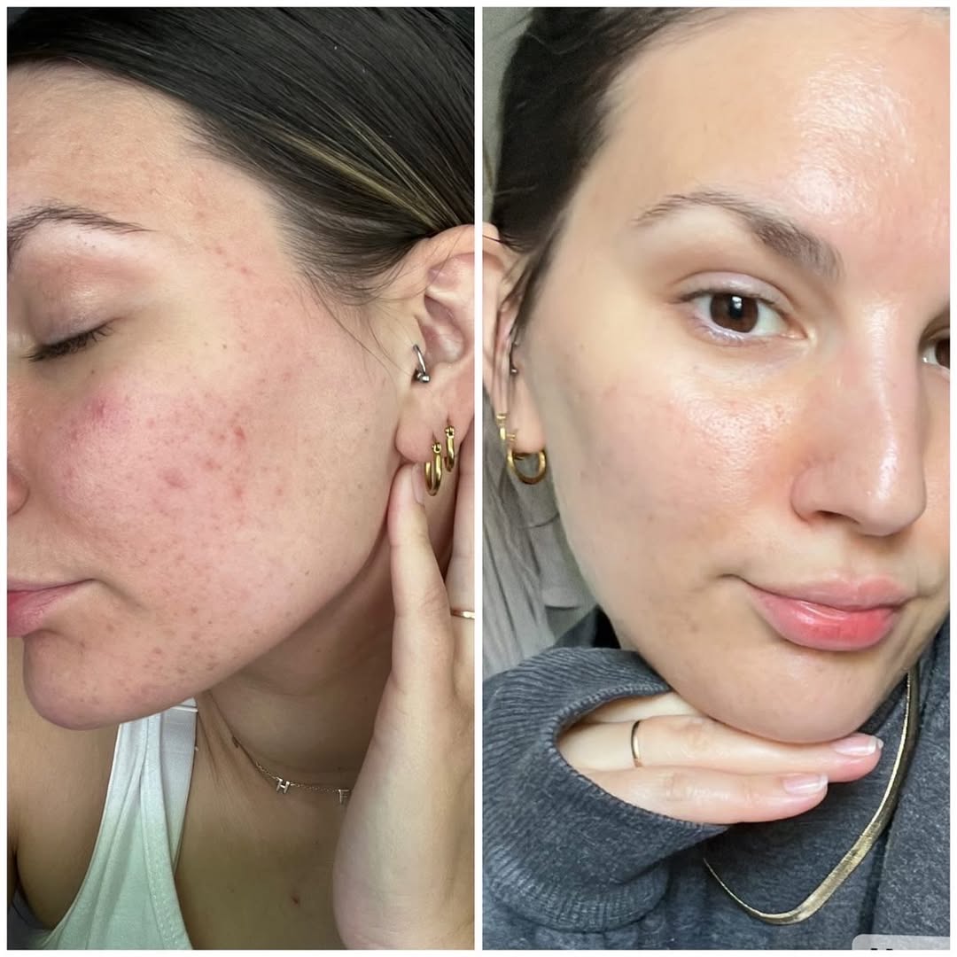 Ouhoe Copper Peptide GHK-Cu (Skin Healing)