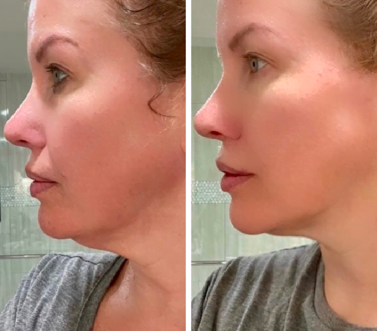 Steel Roller & Gua Sha Tool (Sculpt)